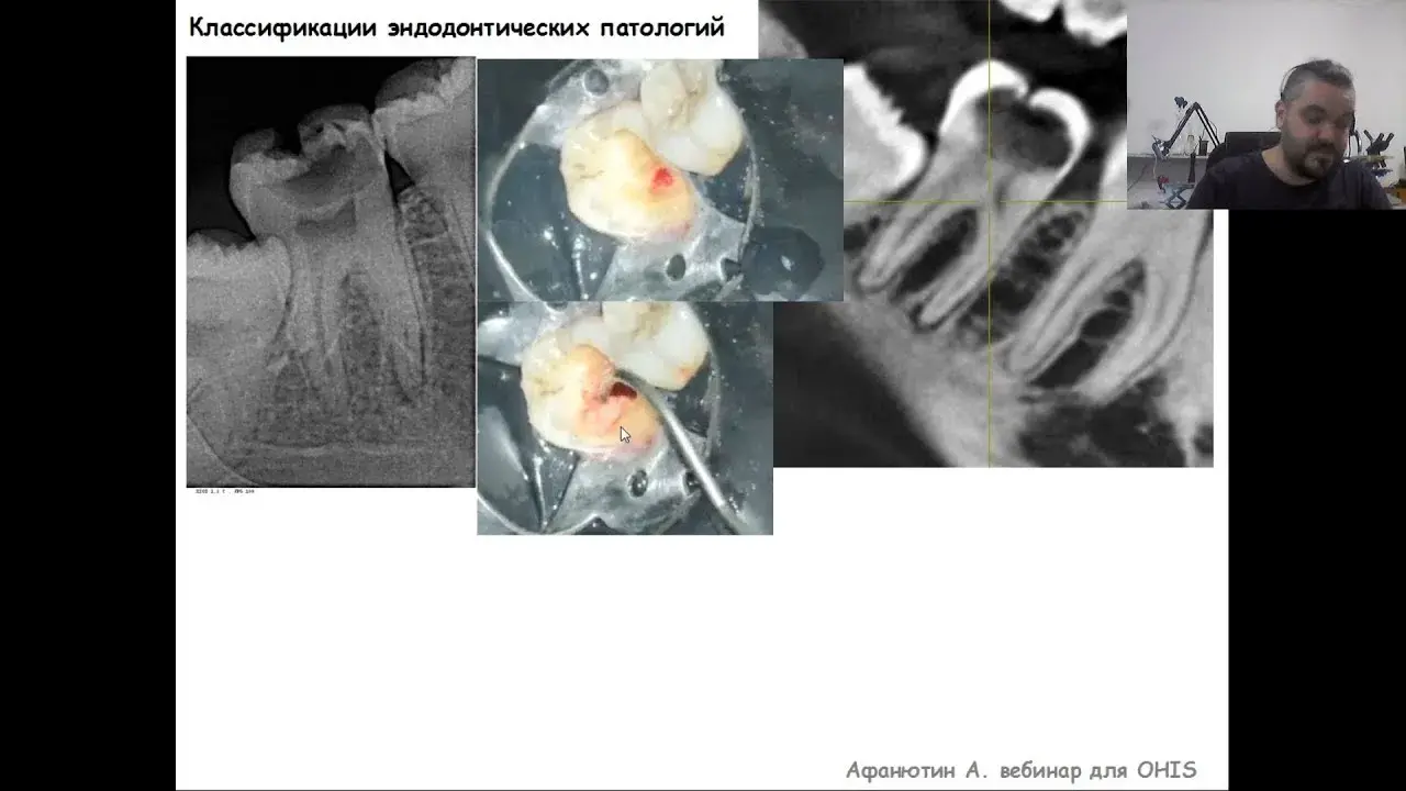 Лектор по эндодонтии ольга землякова учеба. Липатова елена эндодонтия. Добрышина алла владимировна стоматолог. Вебинары эндодонтия. Андрей афанютин эндодонтия.