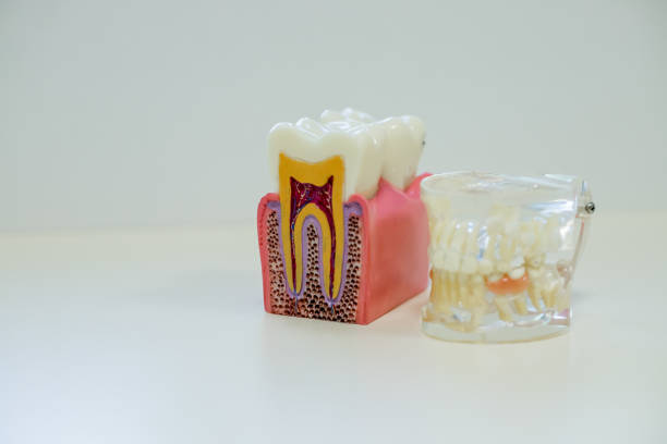 Study on R-Pilot Pathfinding Instrument in Mandibular Molars