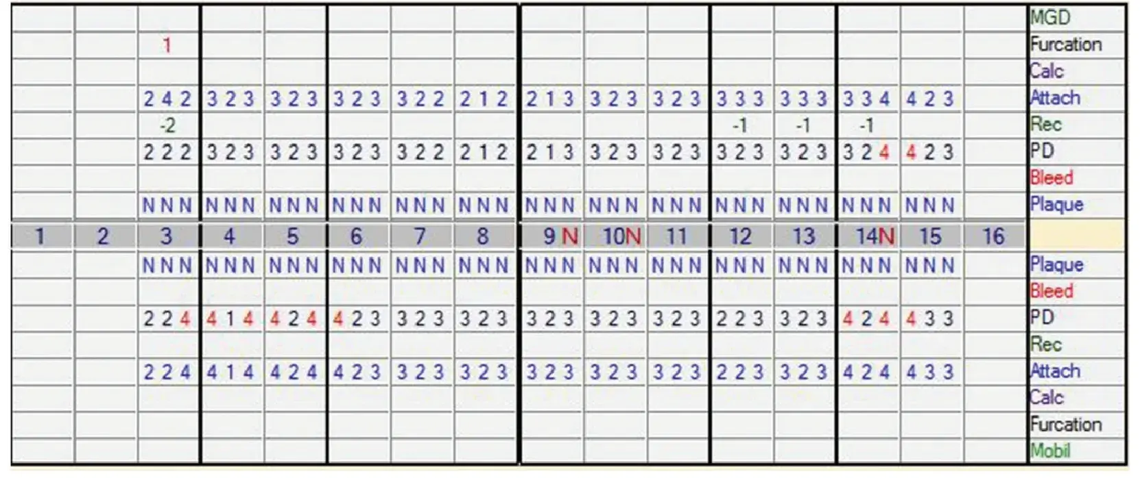 Comparison of bleeding upon probing at individual sites over time