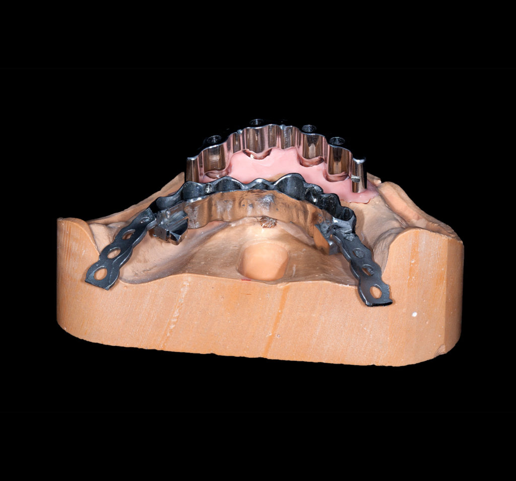 стоматология протезирование фото