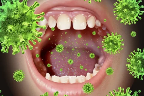 Проявления вирусных инфекций в полости рта