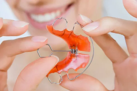 Características generales de los aparatos de ortodoncia.