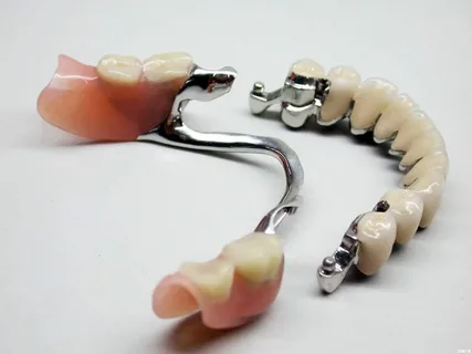 Для чего нужны замковые крепления в стоматологии