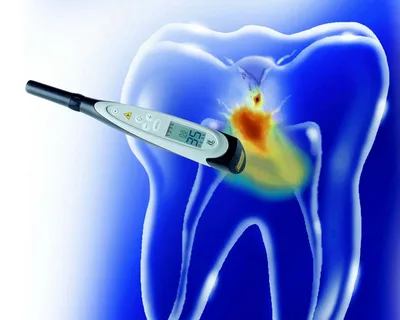 Endodontic treatment planning