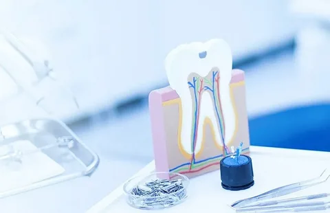 Concepto moderno de tratamiento de endodoncia.
