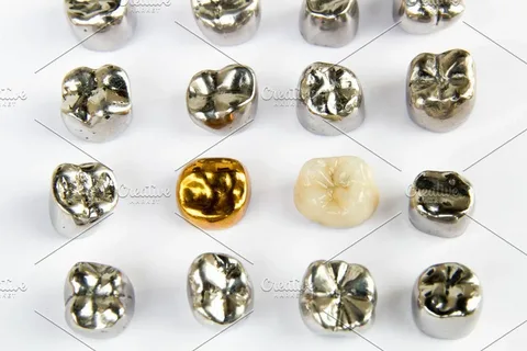 The use of metals in orthopedic dentistry
