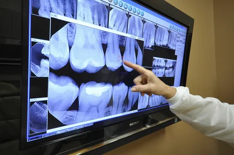 Методы рентгенологической диагностики в стоматологии
