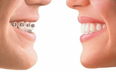 Características gerais das anomalias da dentição