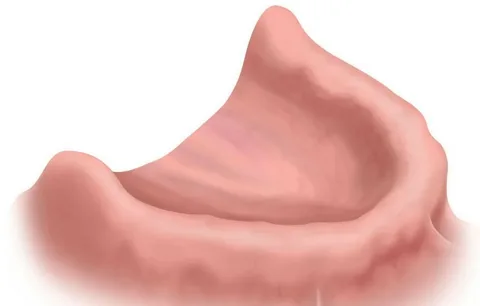 Características de la estructura de las mandíbulas desdentadas.