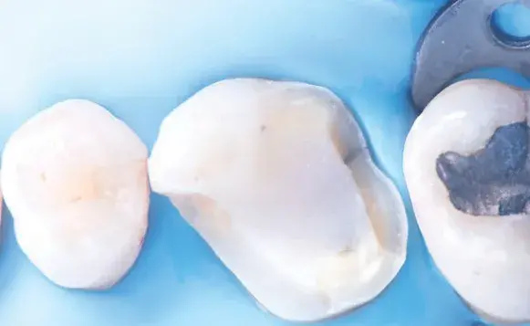 Tooth preparation and isolation