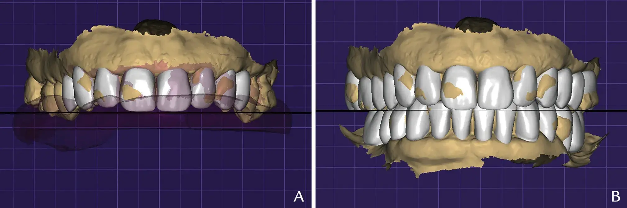 Digital smile design