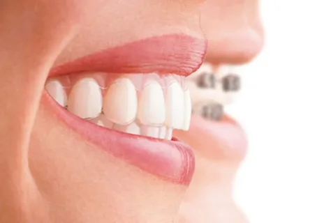 Norma e patologia in ortodonzia
