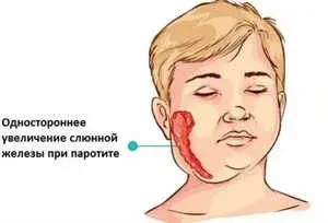Воспаления в полости рта и их лечение
