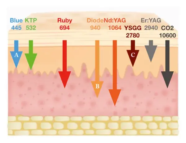 Penetration of different wavelengths in soft tissue