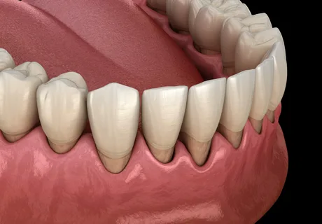 Grundlagen der chirurgischen Parodontologie