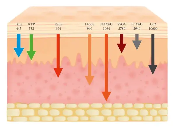 laser wavelengths