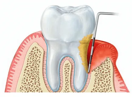 La estructura de los tejidos periodontales.