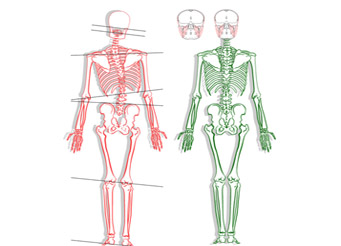 Остеопатическая Стоматология: Влияние Положения Нижней Челюсти На Скелетно-Мышечную Систему