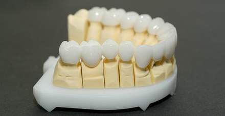 Металл цирконий в стоматологии