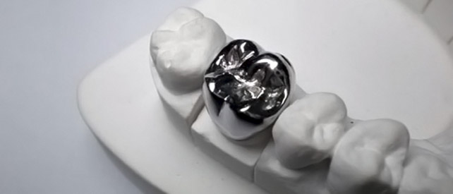 Неблагородные сплавы металлов в стоматологии ортопедической