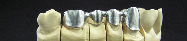 Никель хромовые сплавы каркас в стоматологии