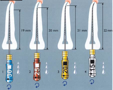 Методики Использования Эндодонтического Инструментария