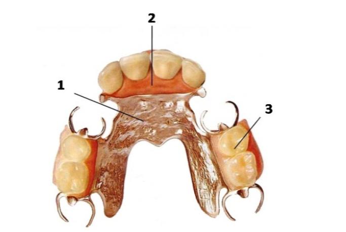 Что такое бюгельное протезирование зубов - стоматология "Магия" Челябинск