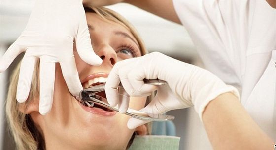 Осложнения во время удаления зубов. Вывих, перелом, аспирация
