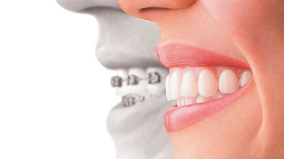 Современные Аспекты Функционального Ортодонтического Лечения