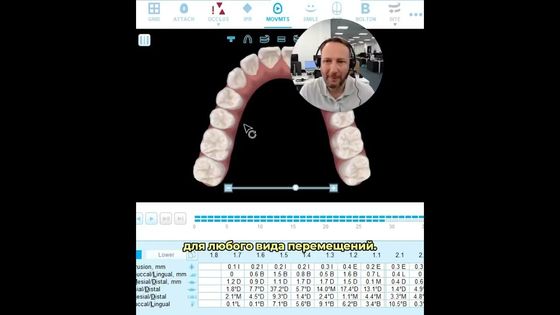 Предсказуемость ротационного перемещения зубов при лечении на элайнерах. 3 подсказки