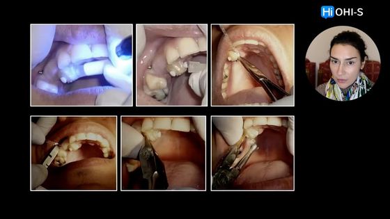 Обучение №1 среди докторов по лечению импакции зубов. Обзор курса Patricia Vergara