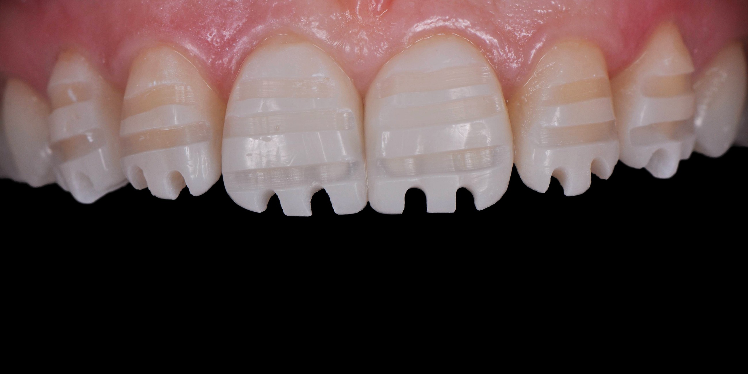 Ceramic restorations, preparation, CAD/CAM - online course