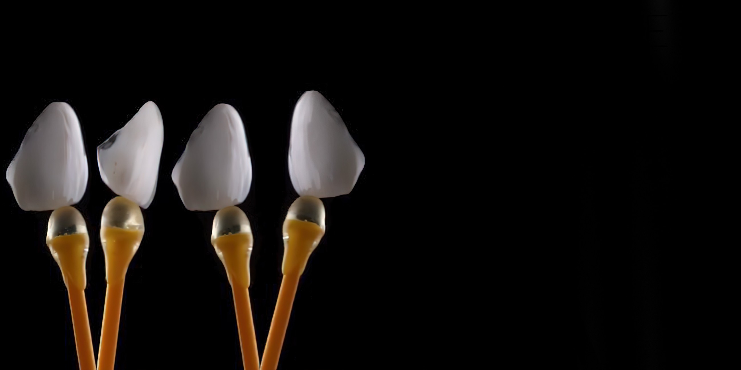 Online course on the manufacture of ceramic veneers, CAD/CAM