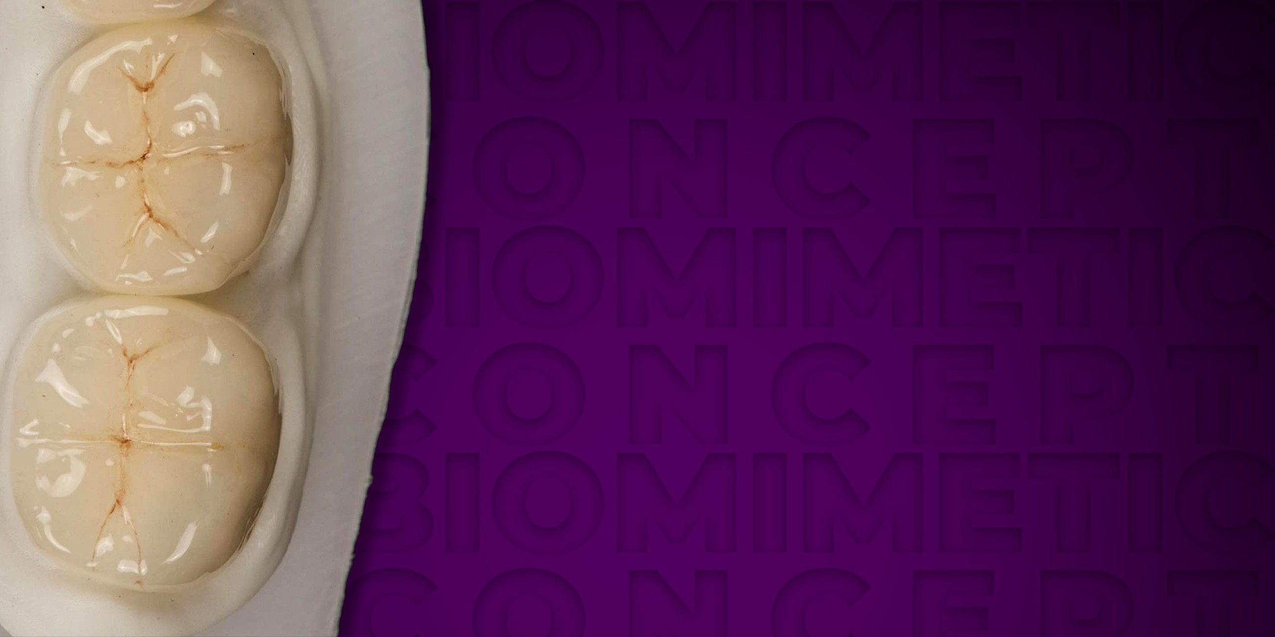 Biobase for Optimized Restoration of Endodontically Treated Teeth with