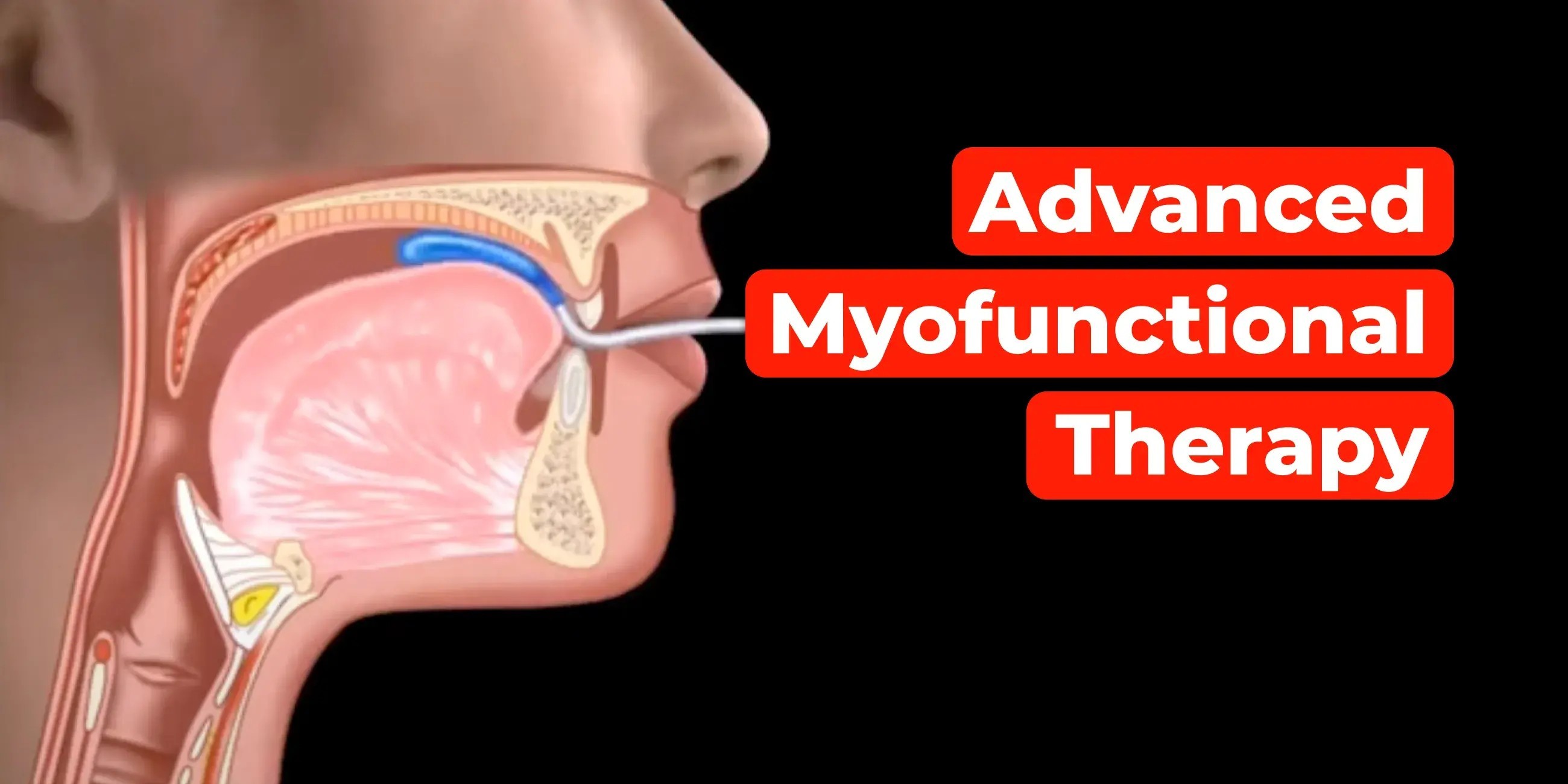 Advanced Myofunctional Therapy: Integrating Technology in Clinical Practice