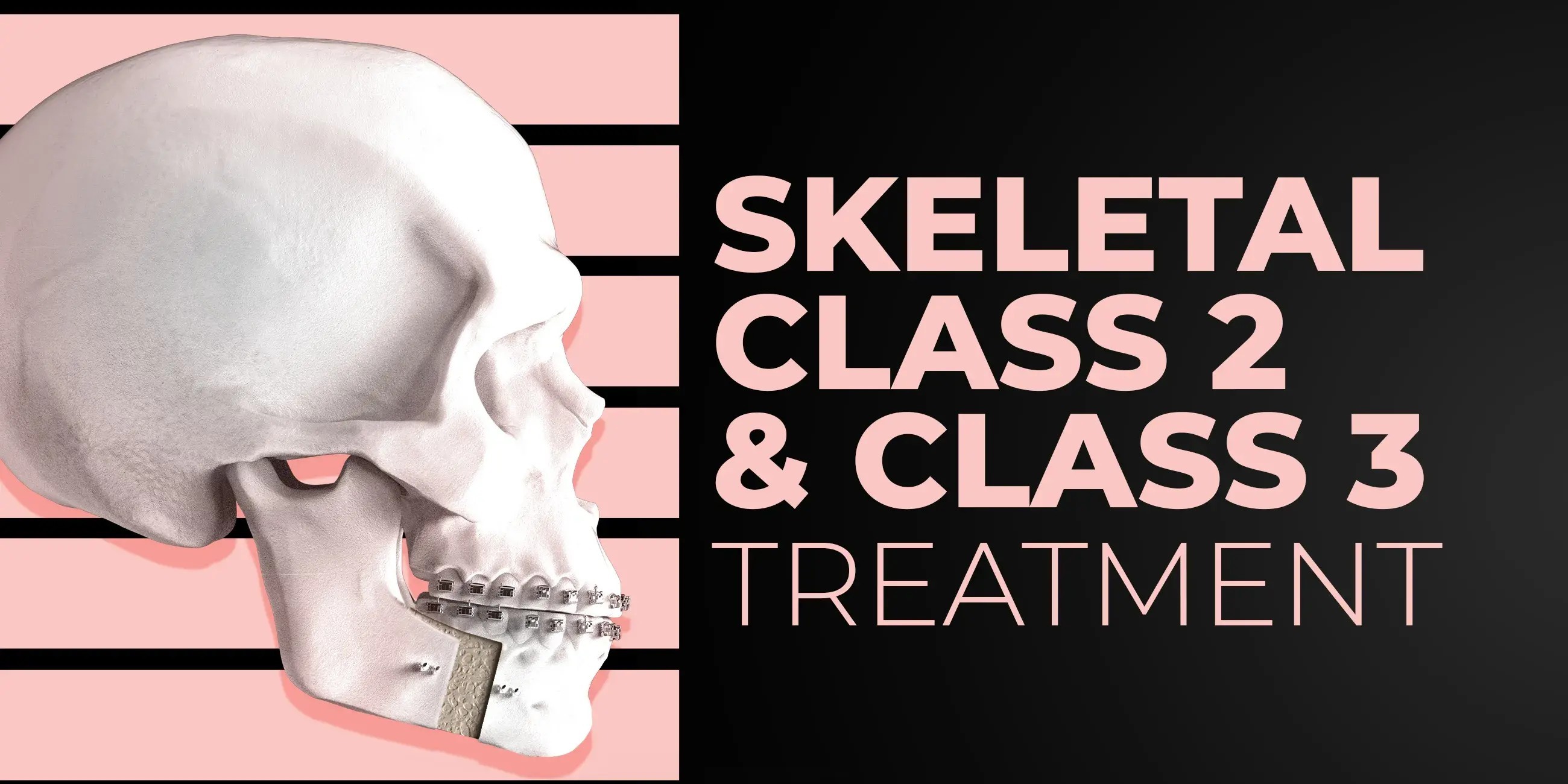 Skeletal problems in Orthodontics, diagnostics, webinar