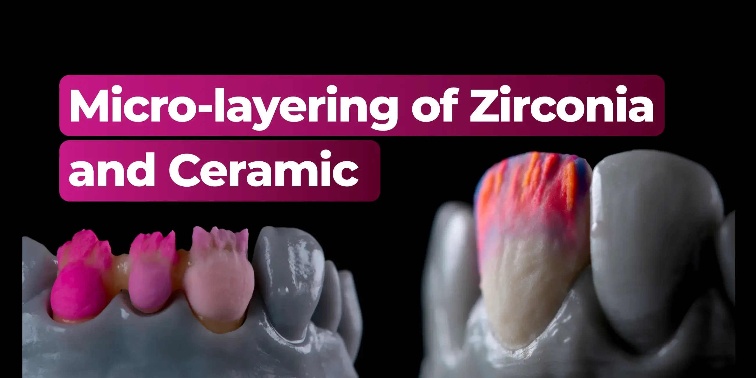 Micro-layeringofZirconiaandCeramic:WorkflowforDentalTechniciansandProsthodontists