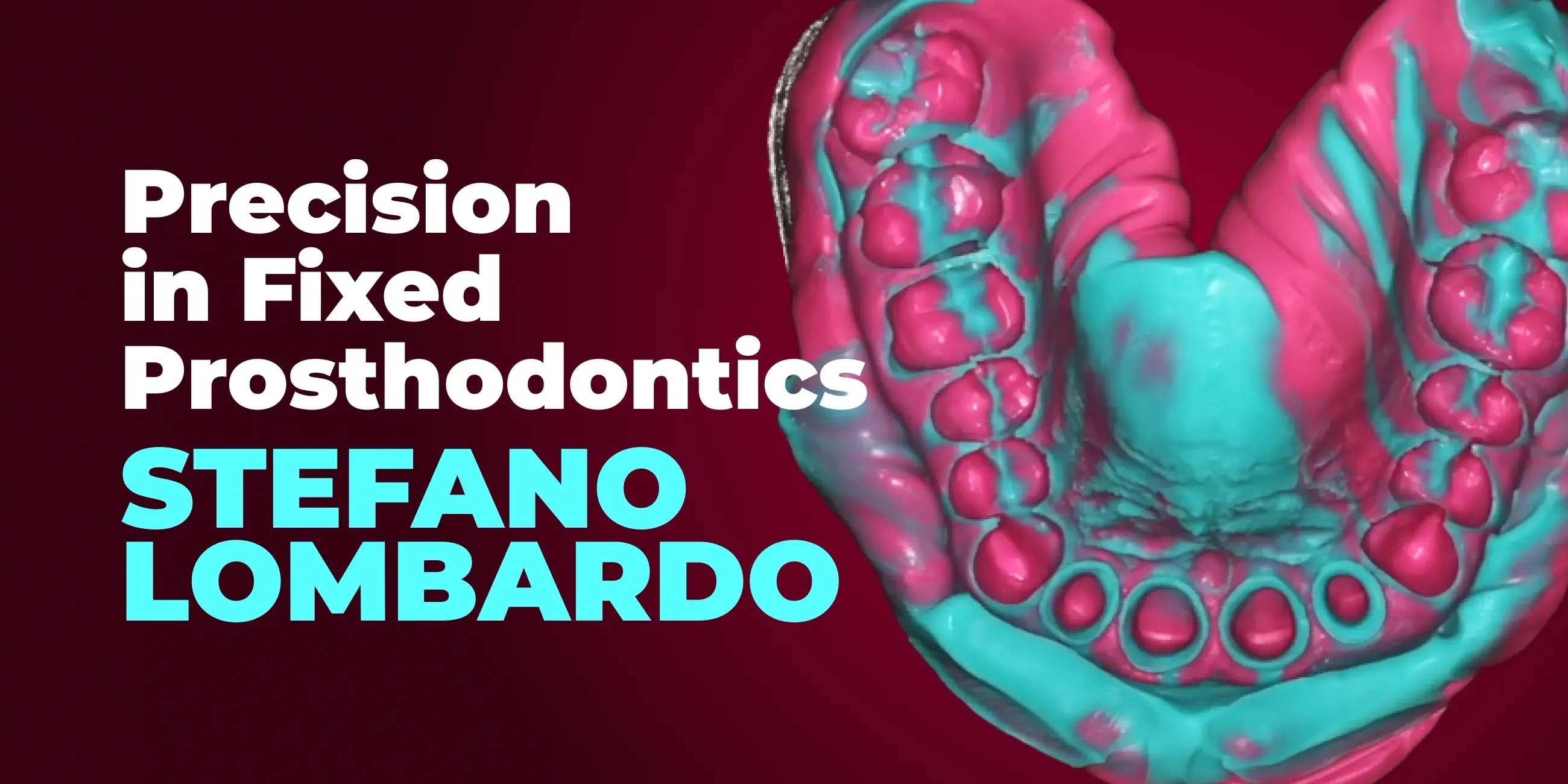 Precision in Fixed Prosthodontics OneStep and TwoStep Impression