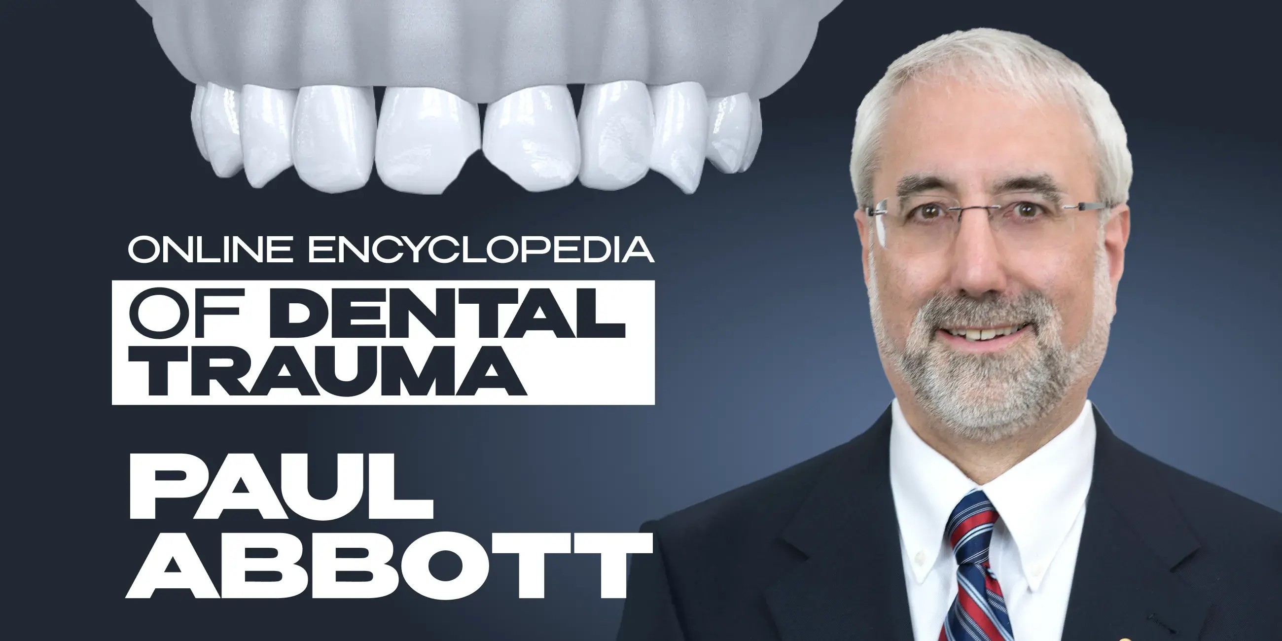 Webinar on management of internal inflammatory resorption
