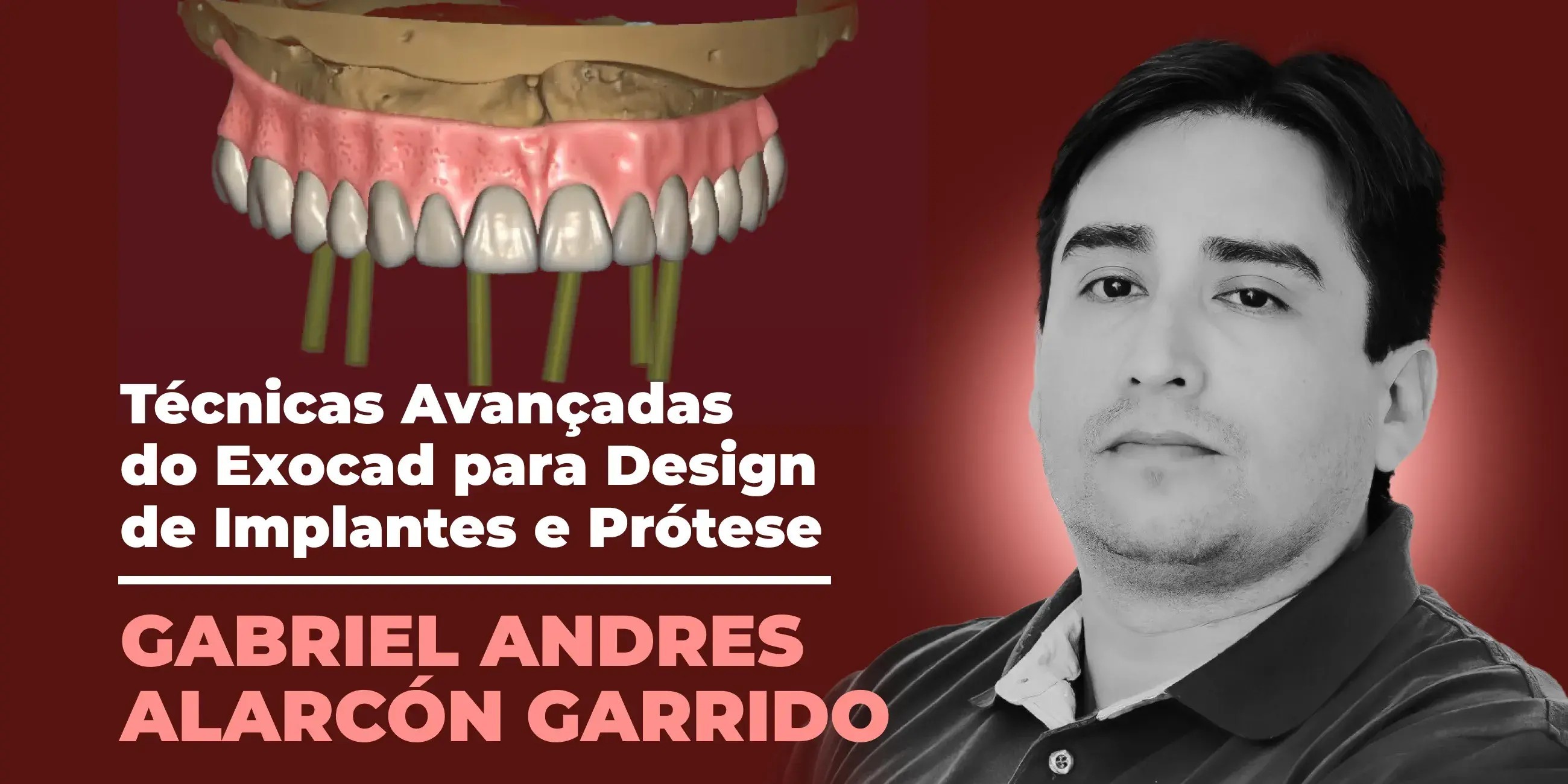 Protese Design Técnicas Avançadas do Exocad para Design de Implantes e Prótese