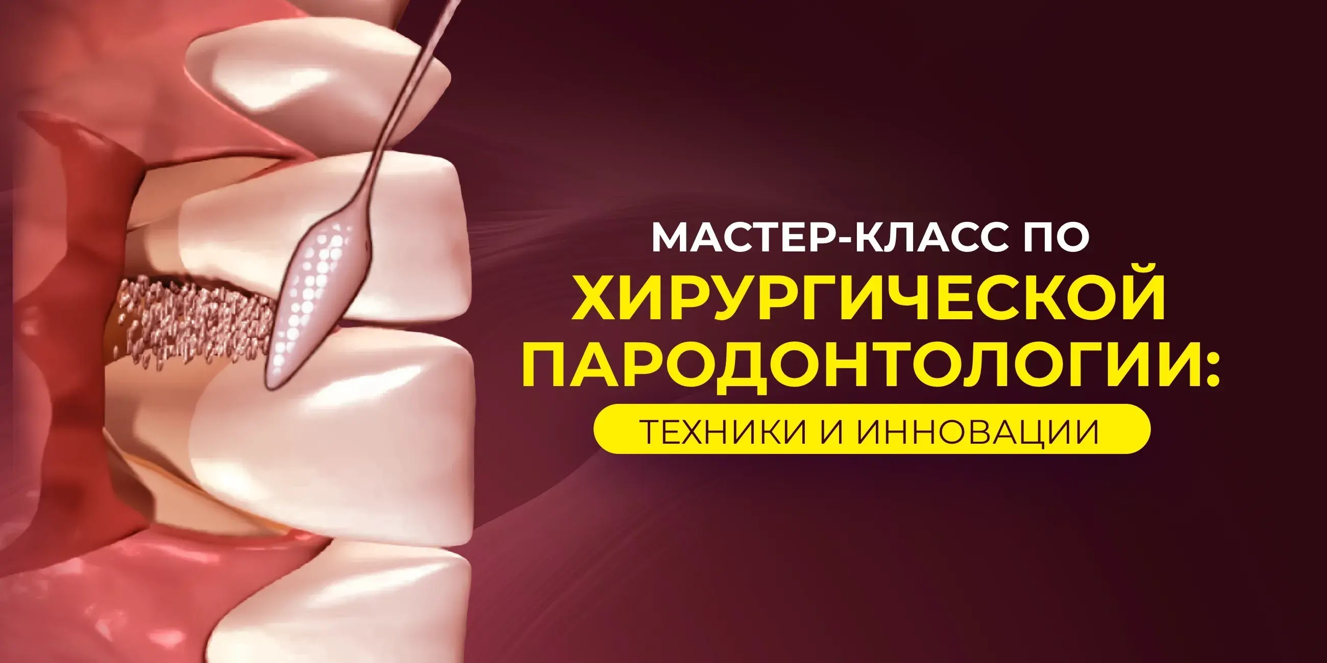 Мастер-класс по хирургической пародонтологии: техники и инновации