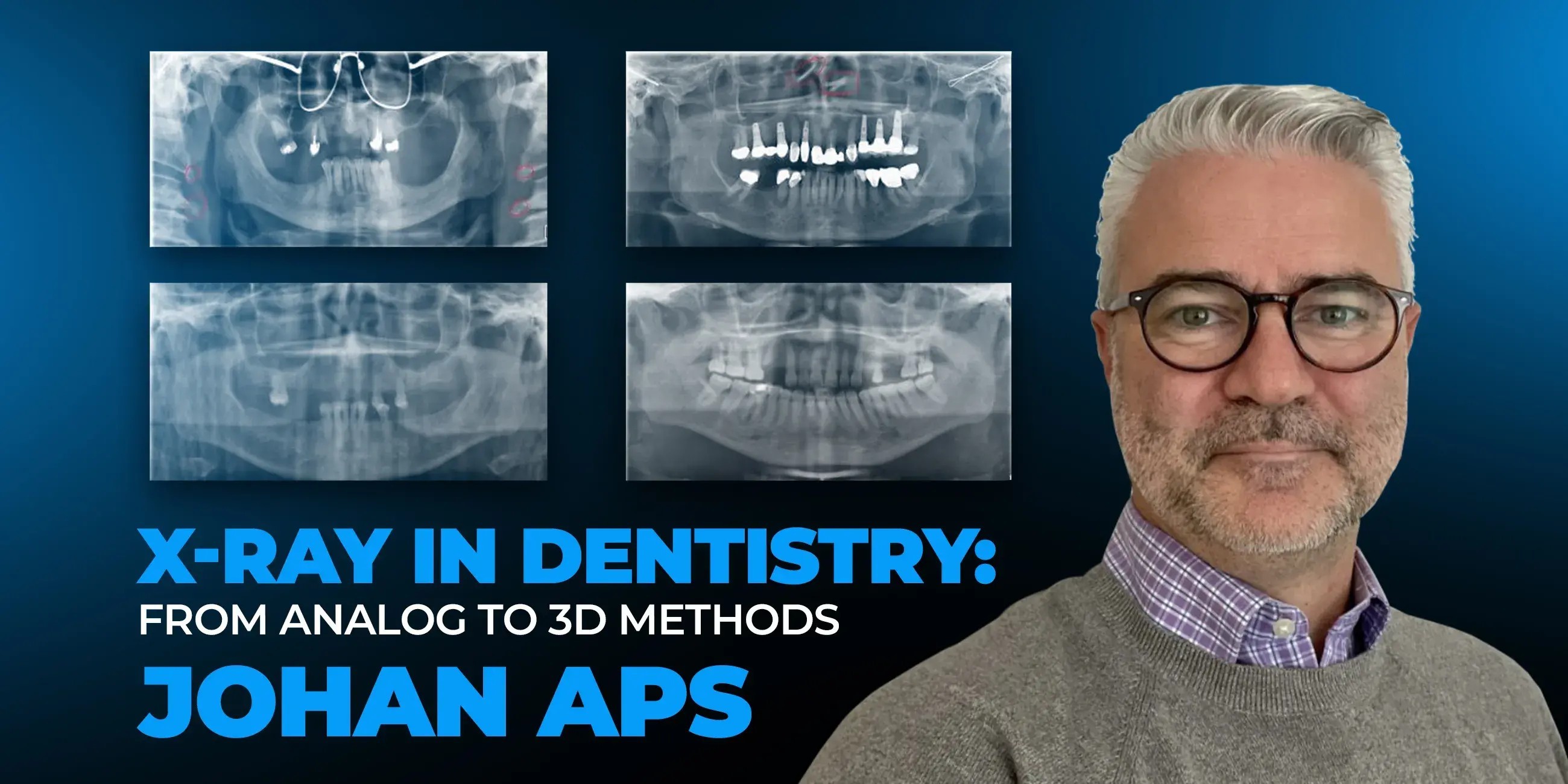 Intraoral radiography: principles and interpretation