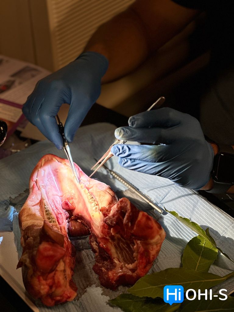 SOLD OUT! Реконструктивная пародонтальная и пластическая хирургия мягких тканей в эстетической зоне. Семинар + демо операции + практика