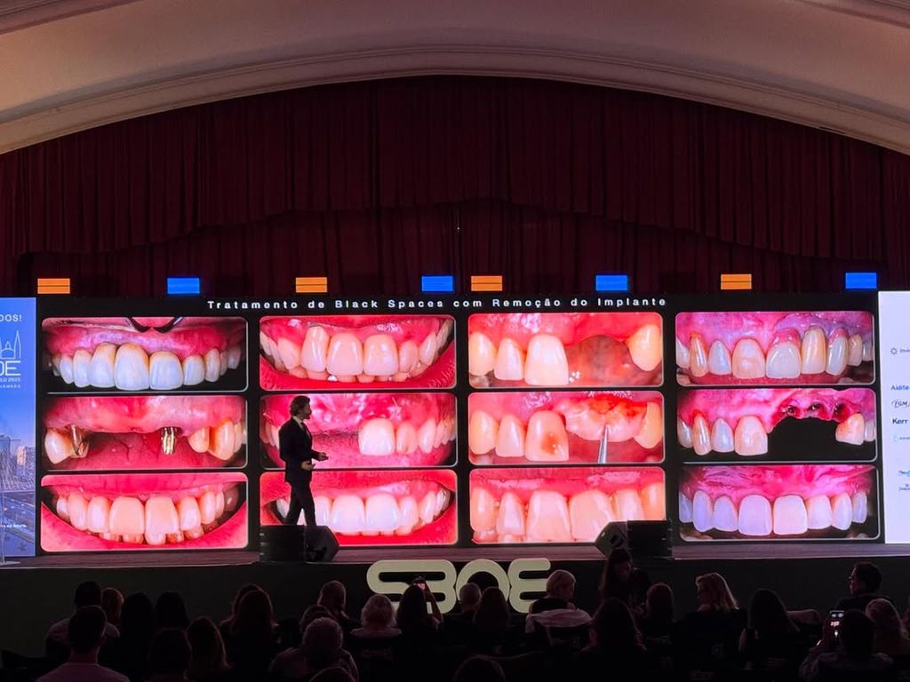 Пластика мягких тканей вокруг имплантов. Практический курс Ricardo Kern