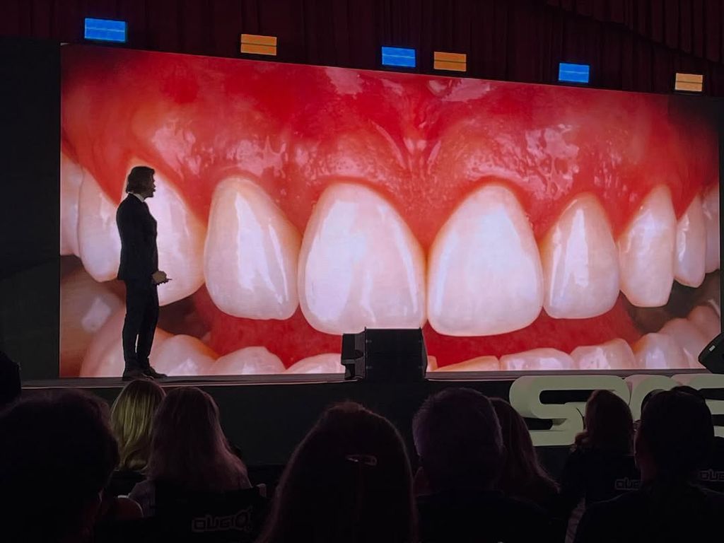 Пластика мягких тканей вокруг имплантов. Практический курс Ricardo Kern