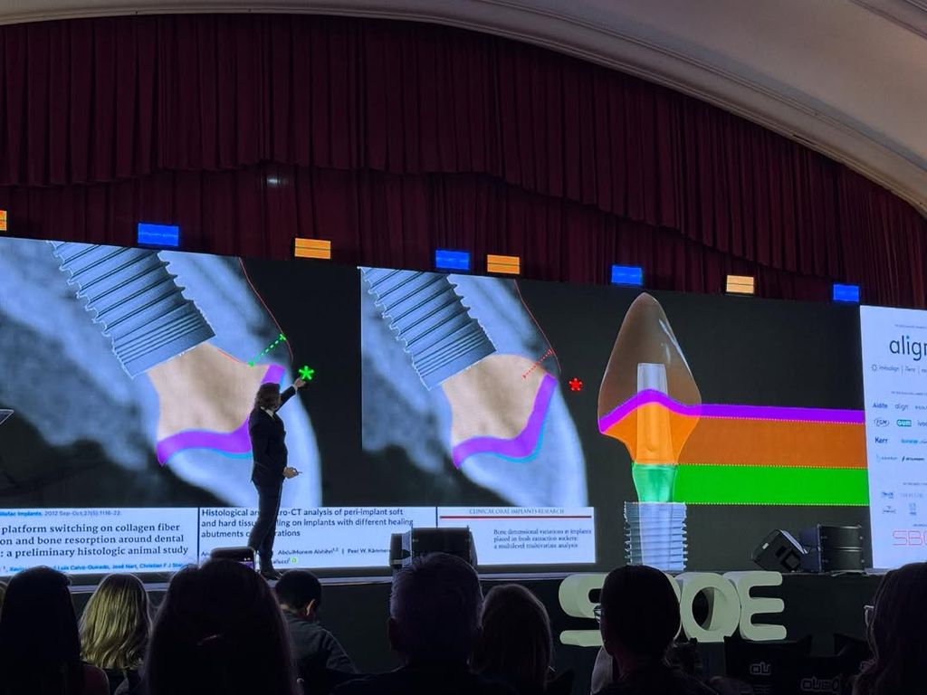 Пластика мягких тканей вокруг имплантов. Практический курс Ricardo Kern