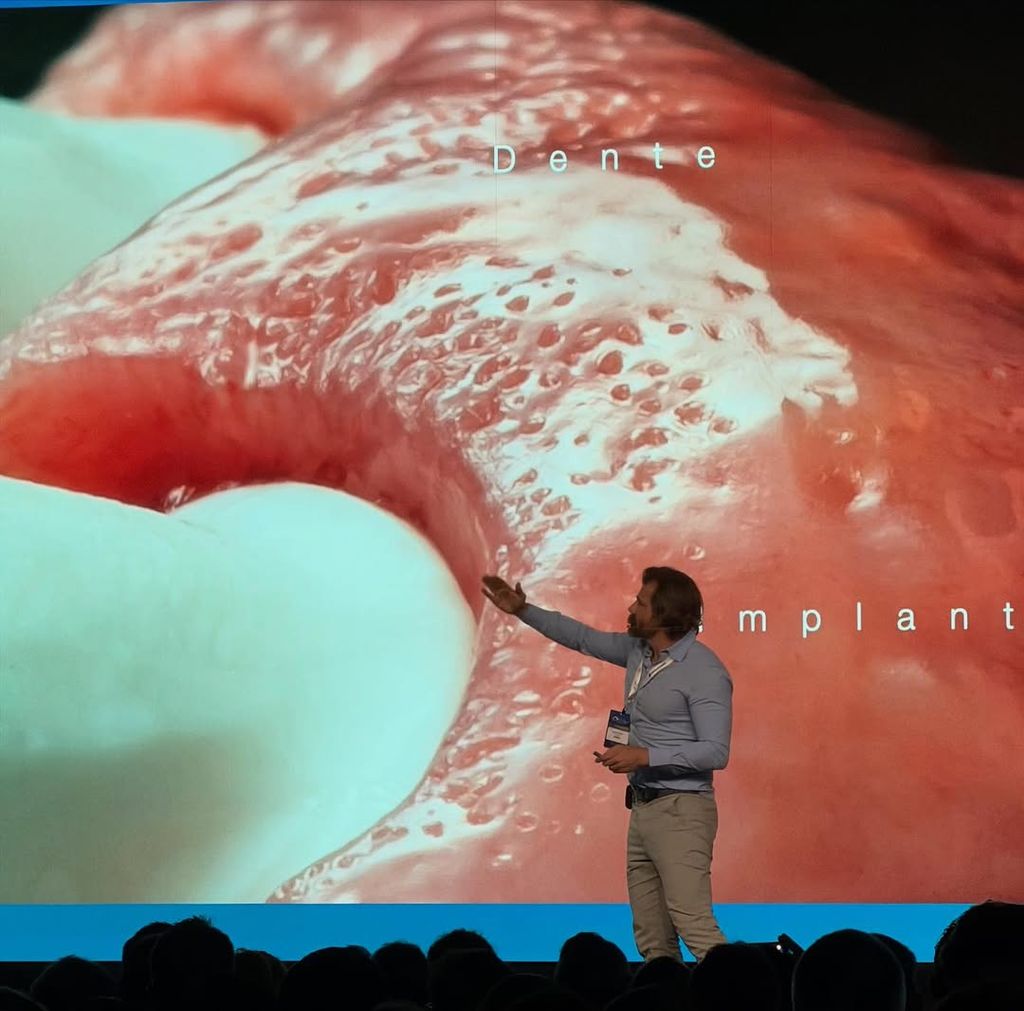 Пластика мягких тканей вокруг имплантов. Практический курс Ricardo Kern