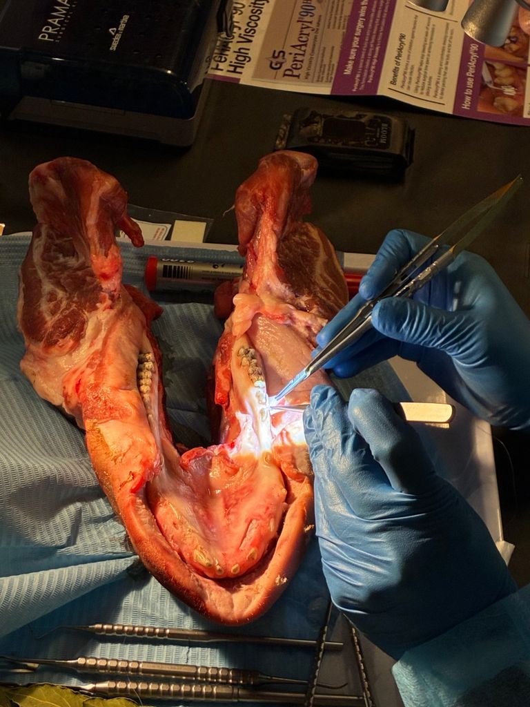 Programa de prácticas en Cirugía Ortognática con el Dr. David Sanz