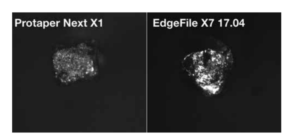 Comparative Study of ProTaper NEXT and EdgeFile X7 Rotary Systems in ...