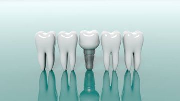 Conceitos de tratamento clínico em doenças periodontais severas Conceitos de tratamento clínico em doenças periodontais severas